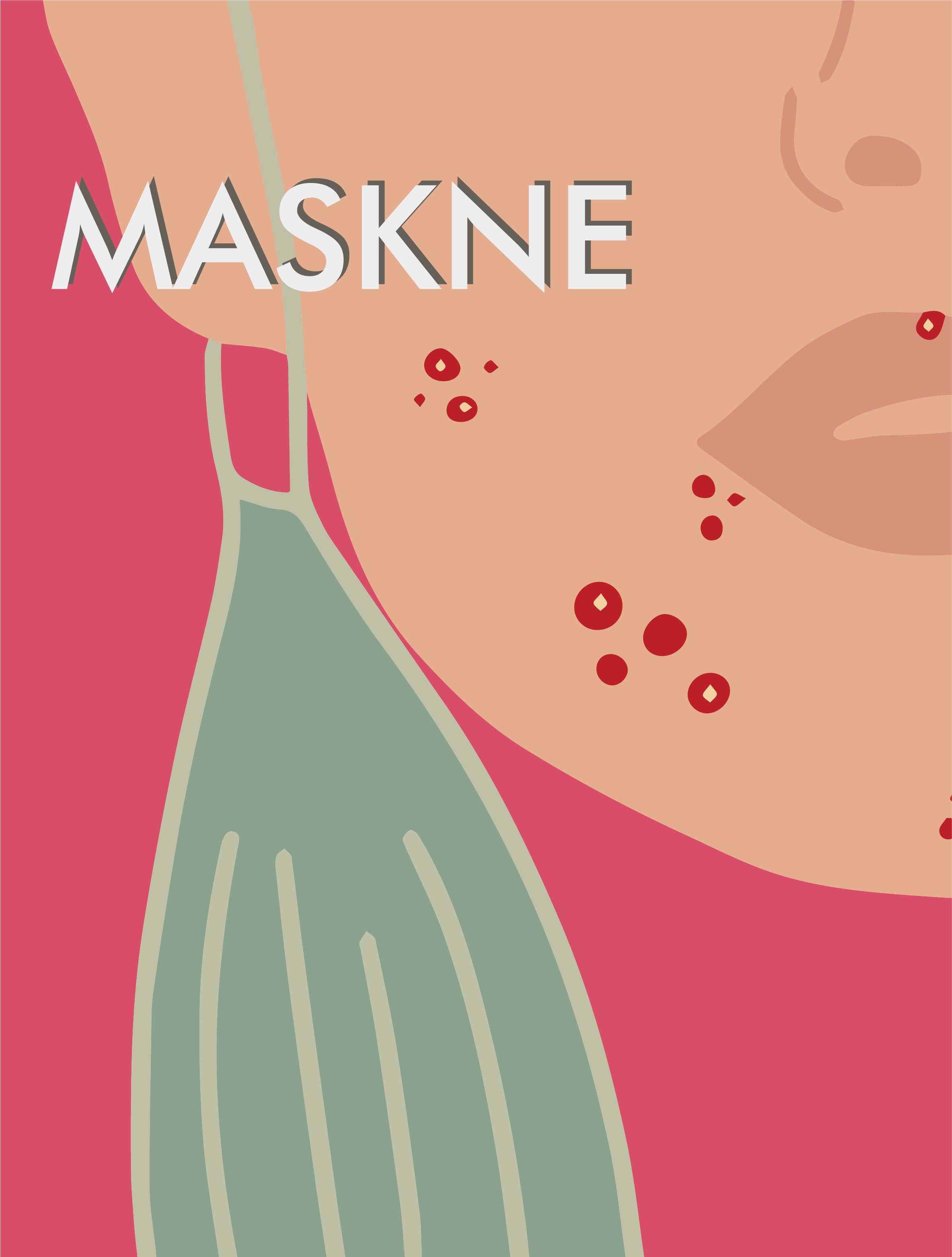 ÇFARË ËSHTË "MASKNE"? SI TA TRAJTOJMË?