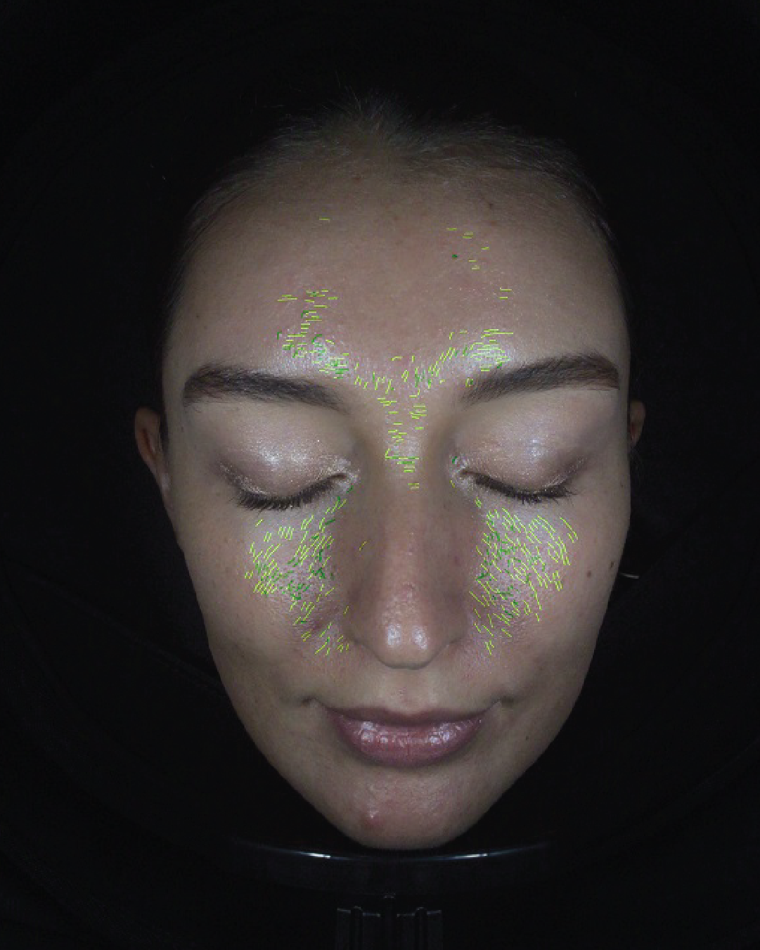 3D Full Facial Skin Analyzer - KORAL SECRETS Flagstore Tirana