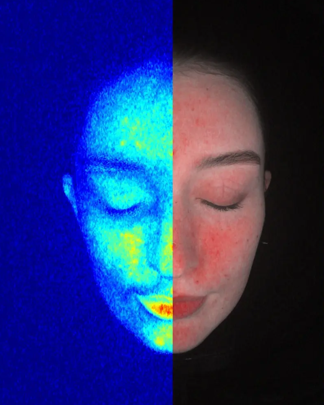 3D Full Facial Skin Analyzer - KORAL SECRETS Flagstore Tirana
